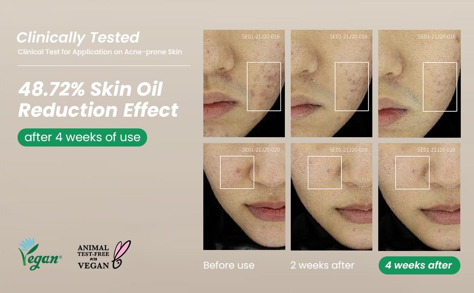 AXIS - Y - Spot The Difference Blemish Treatment 15ml